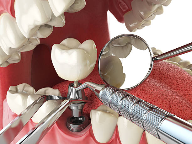 Fast & Reliable Emergency Dental Services in MO